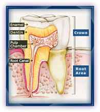 Root Canals Image 1